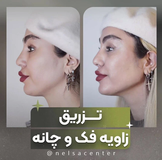 مرکز تخصصی زیبایی نلسا