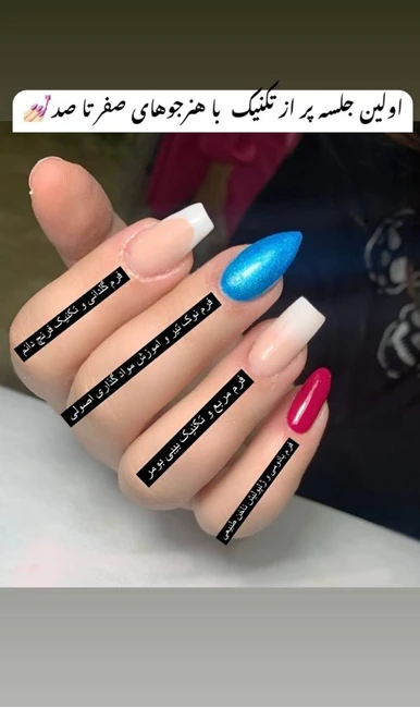 کاشت ناخن 