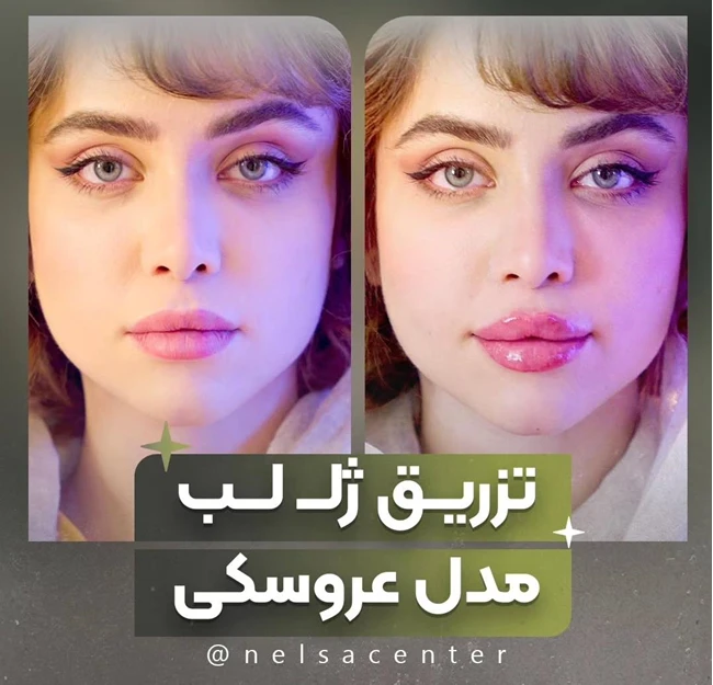 مرکز تخصصی زیبایی نلسا