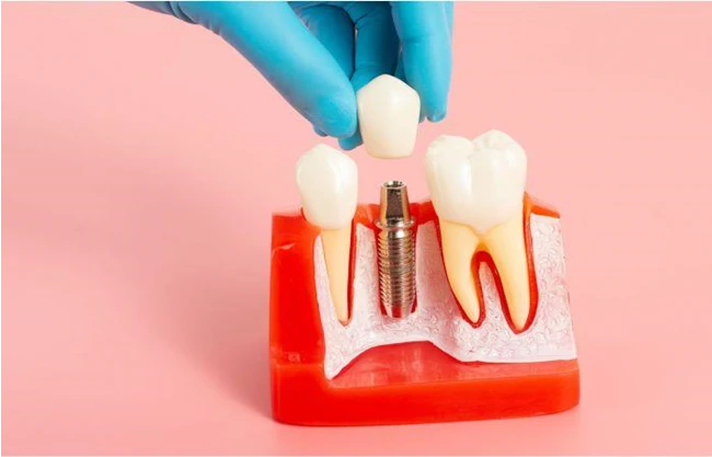 مطب تخصصی دندانپزشکی پاسداران