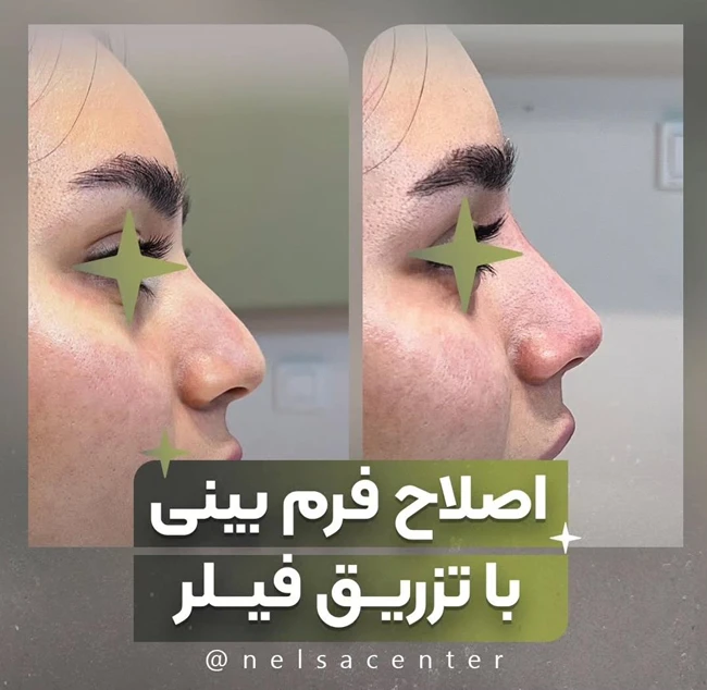 مرکز تخصصی زیبایی نلسا