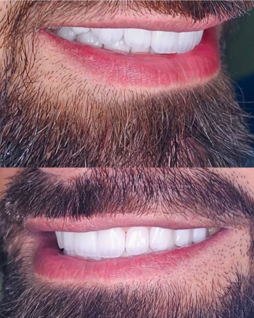 دکتر نیلوفر فایقی - دندانپزشک زیبایی