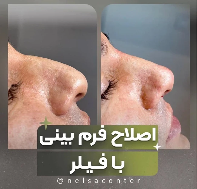 مرکز تخصصی زیبایی نلسا