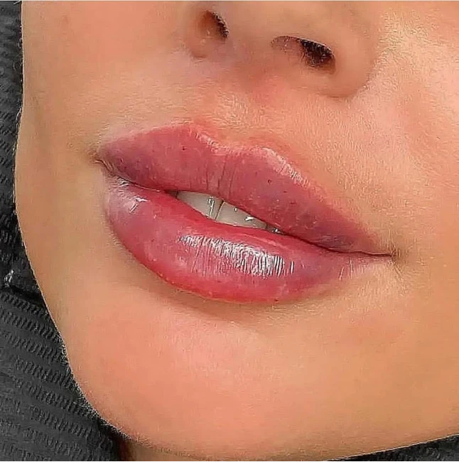 کلینیک لیزر VIP اصفهان