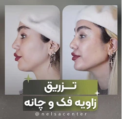 مرکز تخصصی زیبایی نلسا
