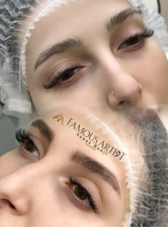 میکروبلیدینگ حرفه ای - تخصصی در تبریز