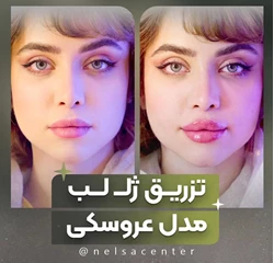 مرکز تخصصی زیبایی نلسا