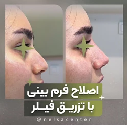 مرکز تخصصی زیبایی نلسا