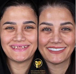 دکتر عزیز گشاده رو - متخصص پروتز و ایمپلنت دندان