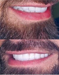 دکتر نیلوفر فایقی - دندانپزشک زیبایی