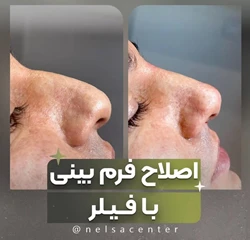 مرکز تخصصی زیبایی نلسا