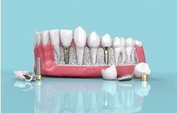 مطب تخصصی دندانپزشکی پاسداران