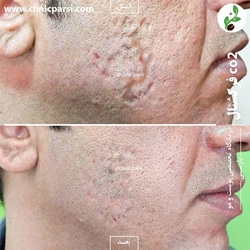 کلینیک پوست و مو پارسی در اصفهان