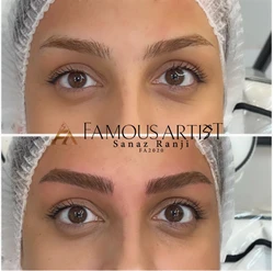 میکروبلیدینگ حرفه ای - تخصصی در تبریز