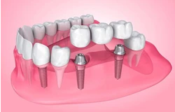 مطب تخصصی دندانپزشکی پاسداران