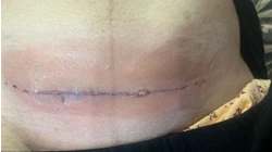 تزریقات پانسمان نوین زخم بستر ویزیت در منزل 