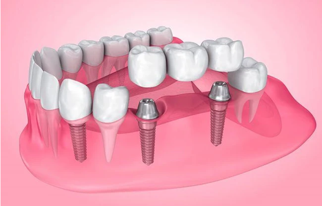مطب تخصصی دندانپزشکی پاسداران