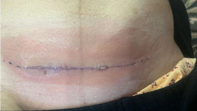 تزریقات پانسمان نوین زخم بستر ویزیت در منزل 