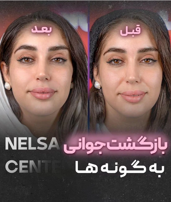 مرکز تخصصی زیبایی نلسا