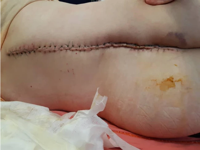 تزریقات پانسمان نوین زخم بستر ویزیت در منزل 