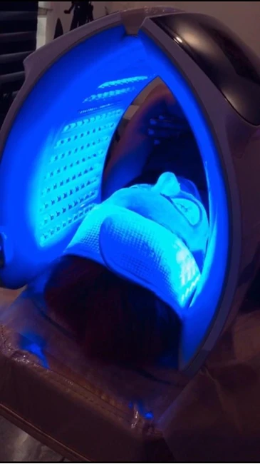 لیزر موهای زائد بدن با دستگاه شاتی