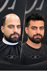 کلینیک پروتز موی آرا