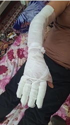 خدمات پرستاری در منزل آنکال سهند
