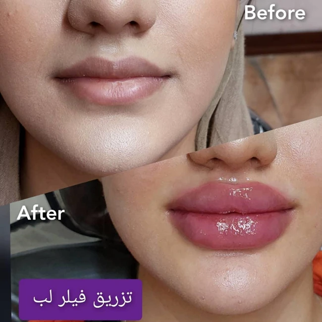 مرکز زیبایی شارلوت