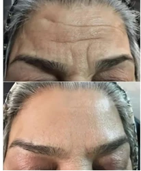 کرم جوانه گندم ویتابلا