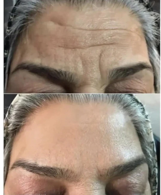کرم جوانه گندم ویتابلا